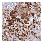 Atlas Antibodies Anti-ZNF627 Antibody