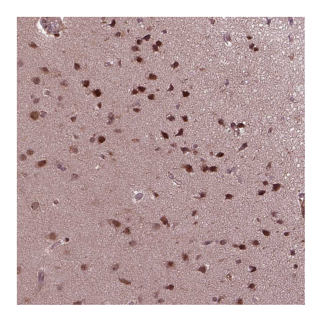 Atlas Antibodies Anti-ZNF630 Antibody