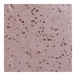 Atlas Antibodies Anti-ZNF630 Antibody