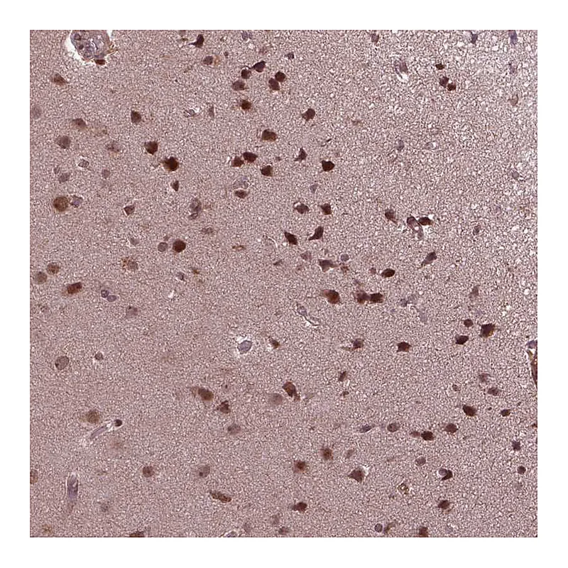Atlas Antibodies Anti-ZNF630 Antibody