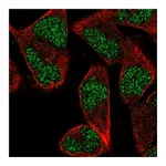 Atlas Antibodies Anti-ZNF627 Antibody