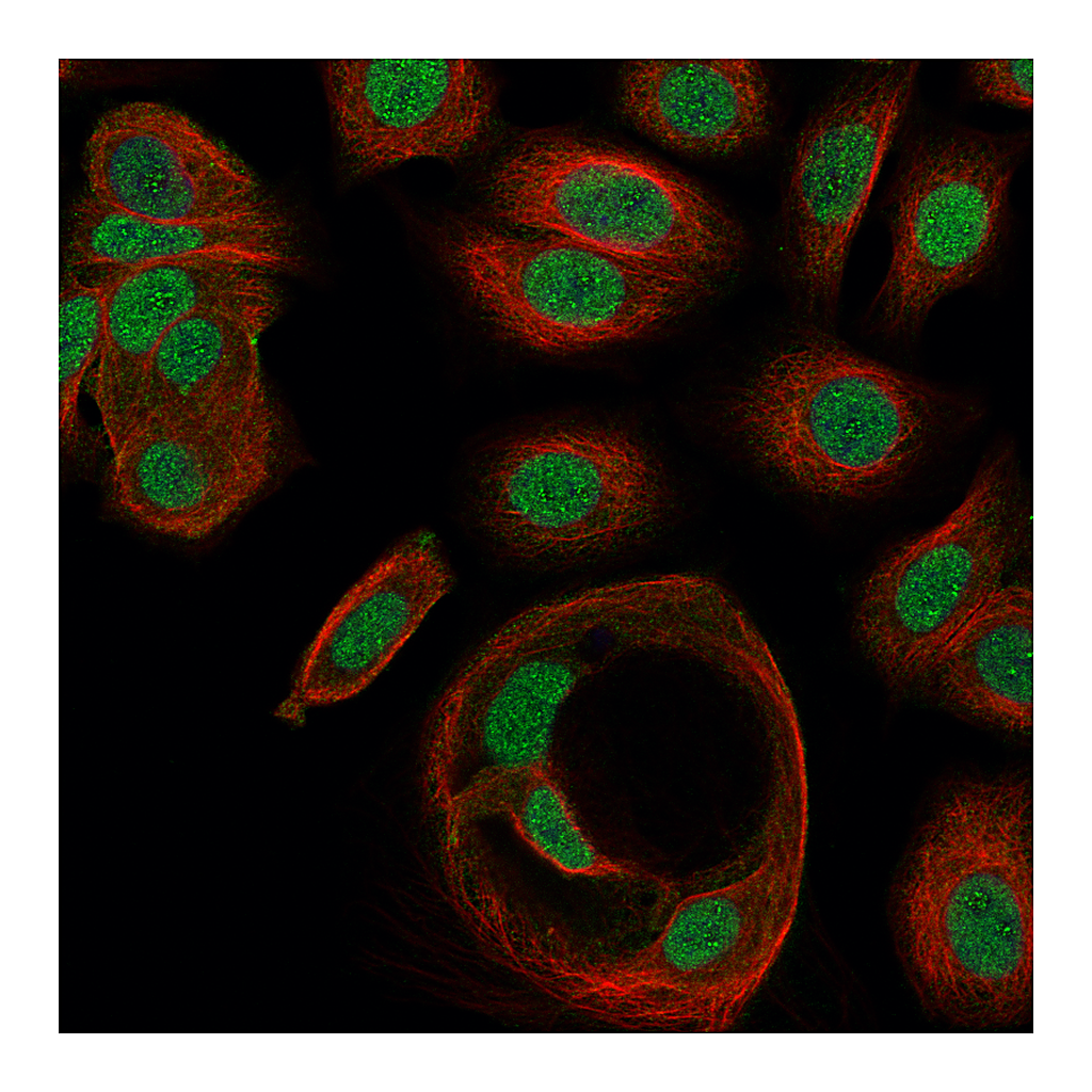 Atlas Antibodies Anti-ZNF629 Antibody