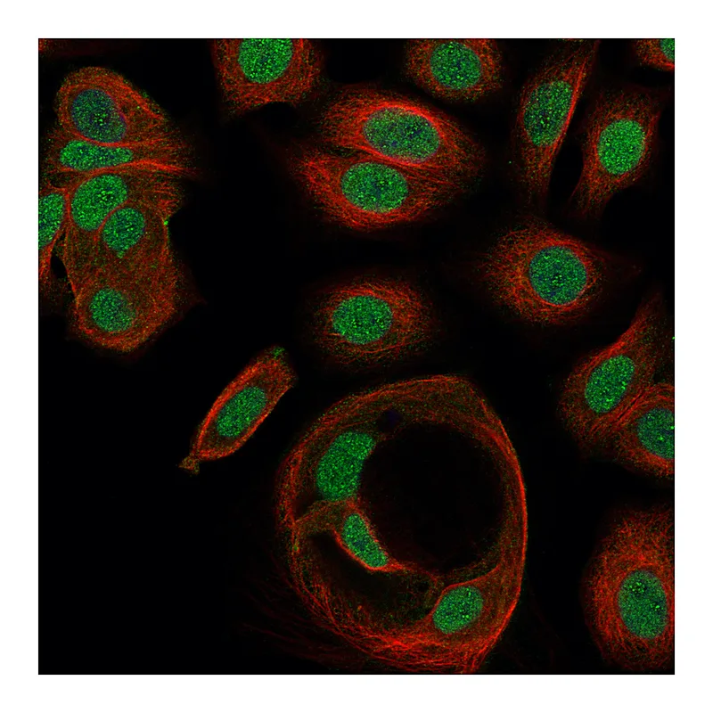 Atlas Antibodies Anti-ZNF629 Antibody