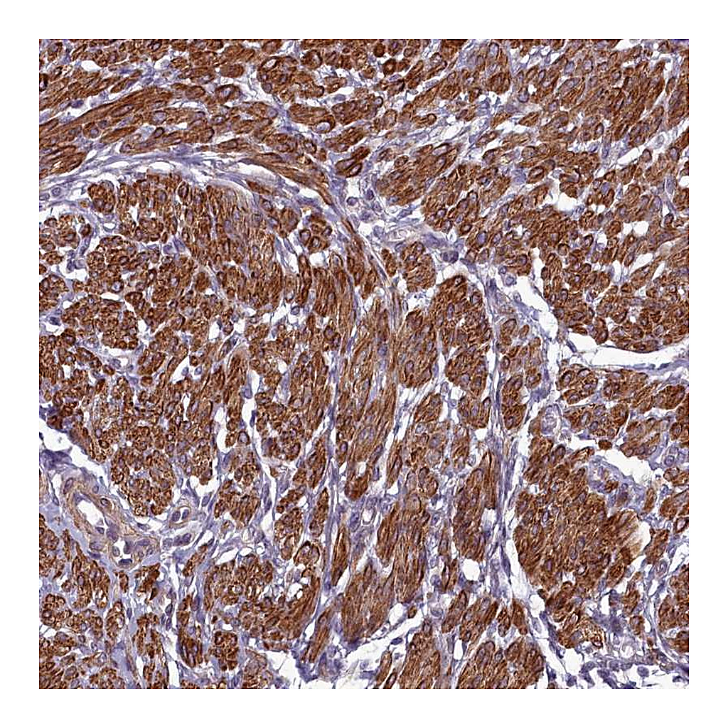 Atlas Antibodies Anti-ZNF626 Antibody
