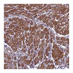 Atlas Antibodies Anti-ZNF626 Antibody