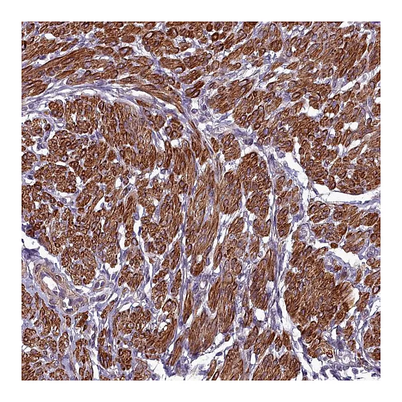 Atlas Antibodies Anti-ZNF626 Antibody