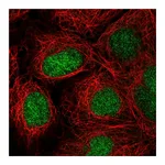 Atlas Antibodies Anti-ZNF629 Antibody