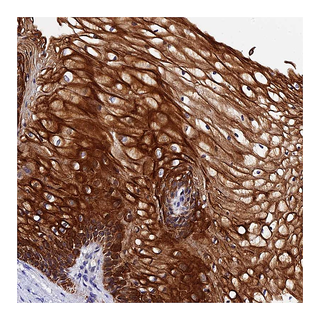 Atlas Antibodies Anti-ZNF628 Antibody