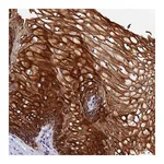 Atlas Antibodies Anti-ZNF628 Antibody