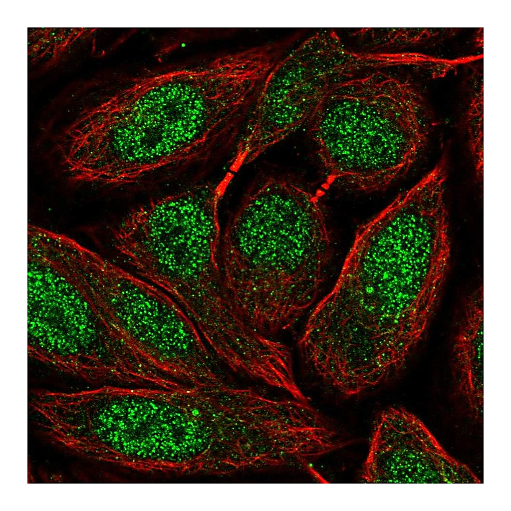 Atlas Antibodies Anti-ZNF630 Antibody