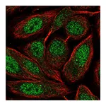Atlas Antibodies Anti-ZNF630 Antibody