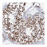 Atlas Antibodies Anti-ZNF638 Antibody