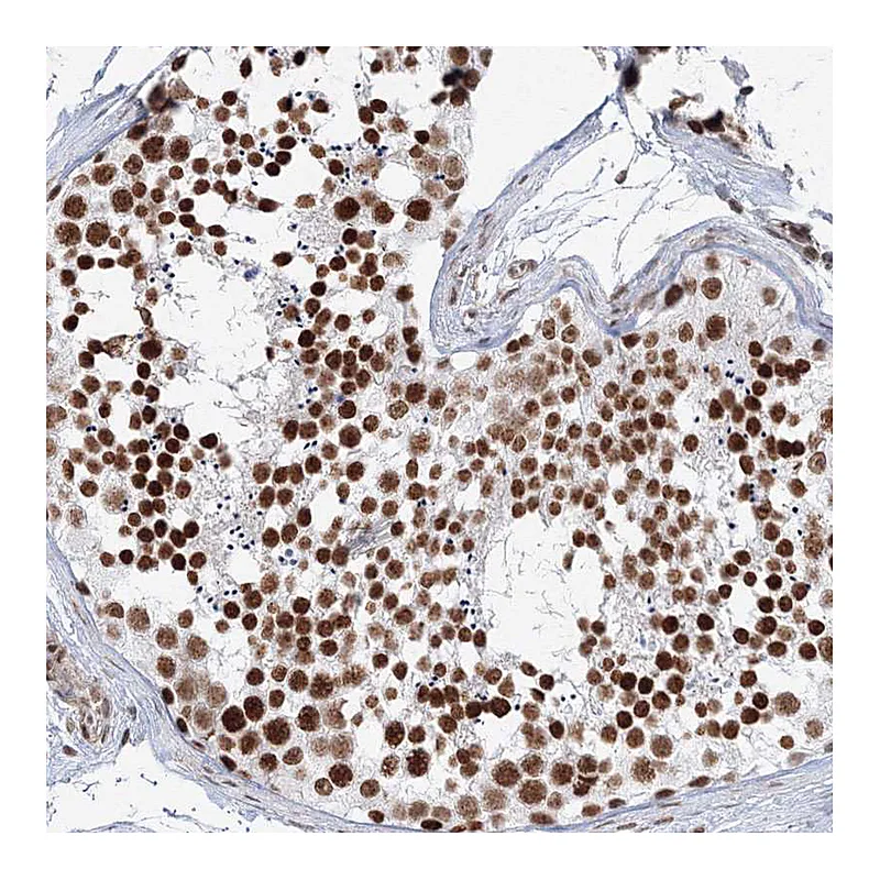 Atlas Antibodies Anti-ZNF638 Antibody
