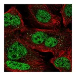 Atlas Antibodies Anti-ZNF638 Antibody