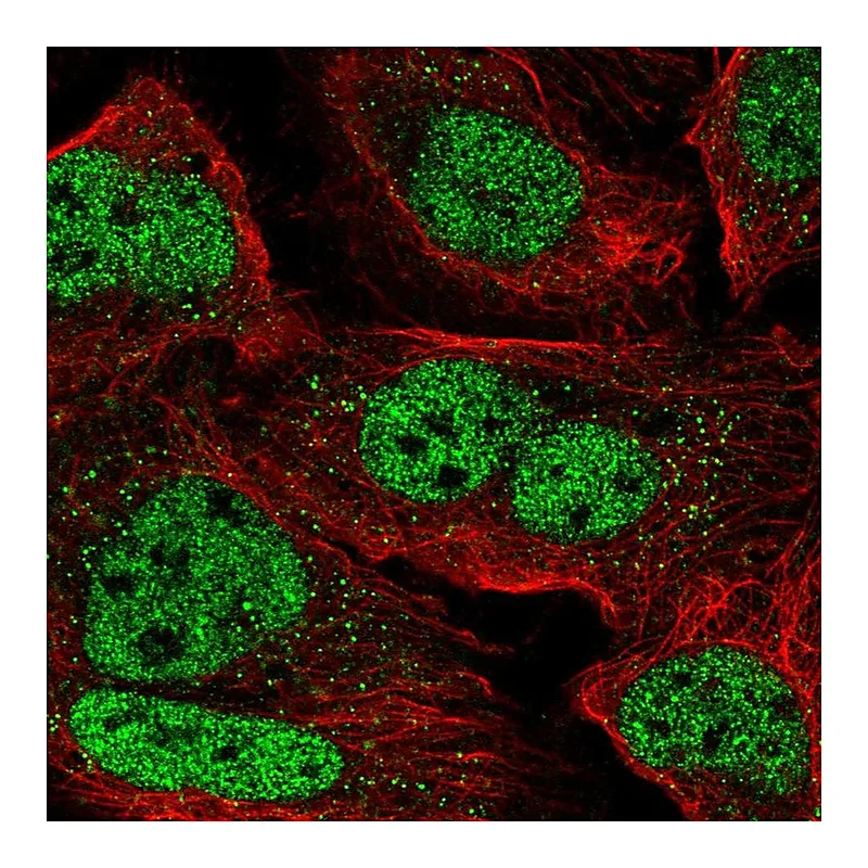Atlas Antibodies Anti-ZNF638 Antibody