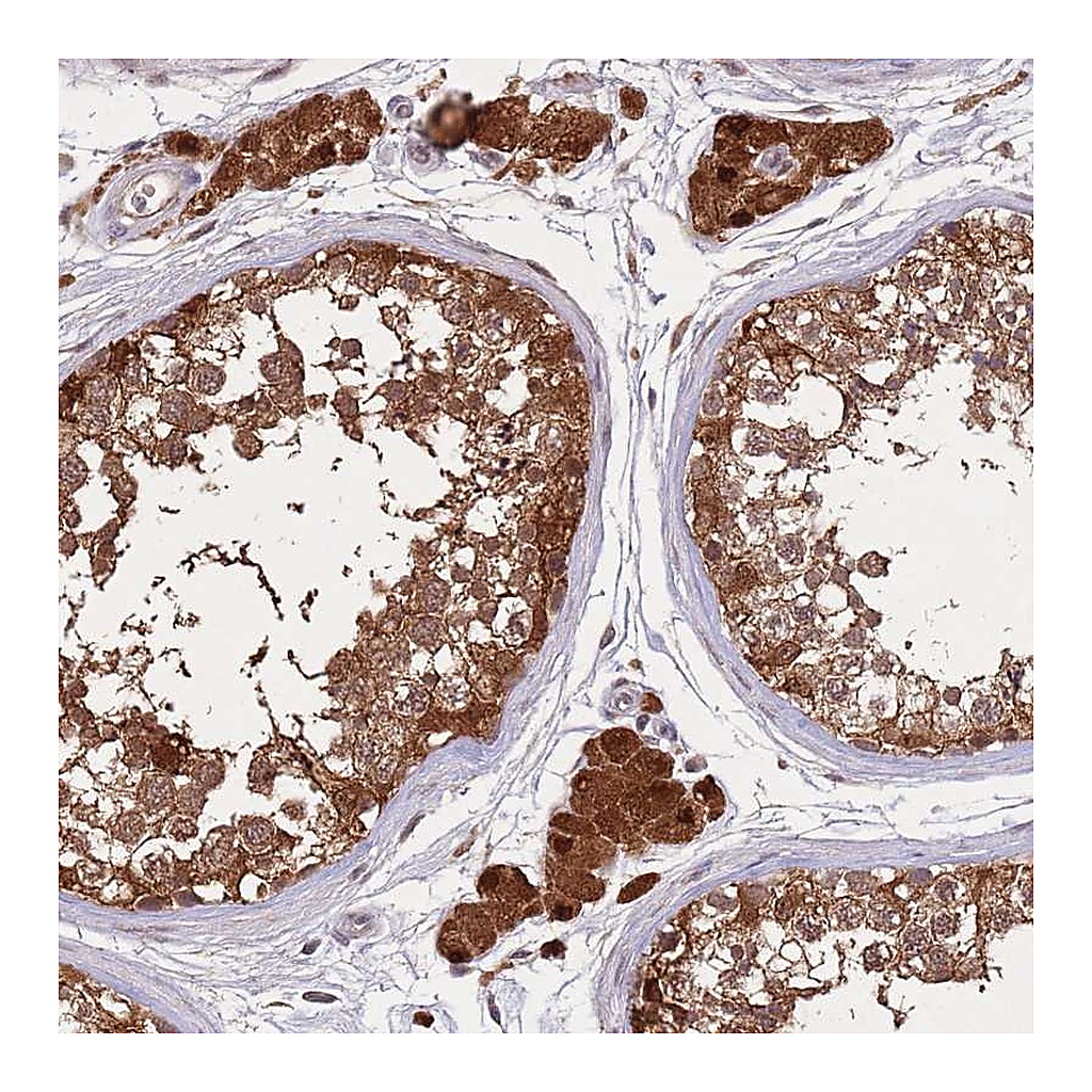 Atlas Antibodies Anti-ZNF639 Antibody