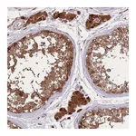 Atlas Antibodies Anti-ZNF639 Antibody