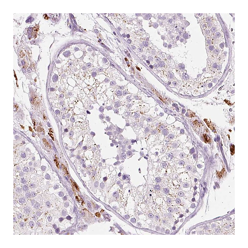 Atlas Antibodies Anti-ZNF639 Antibody