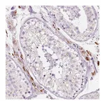 Atlas Antibodies Anti-ZNF639 Antibody