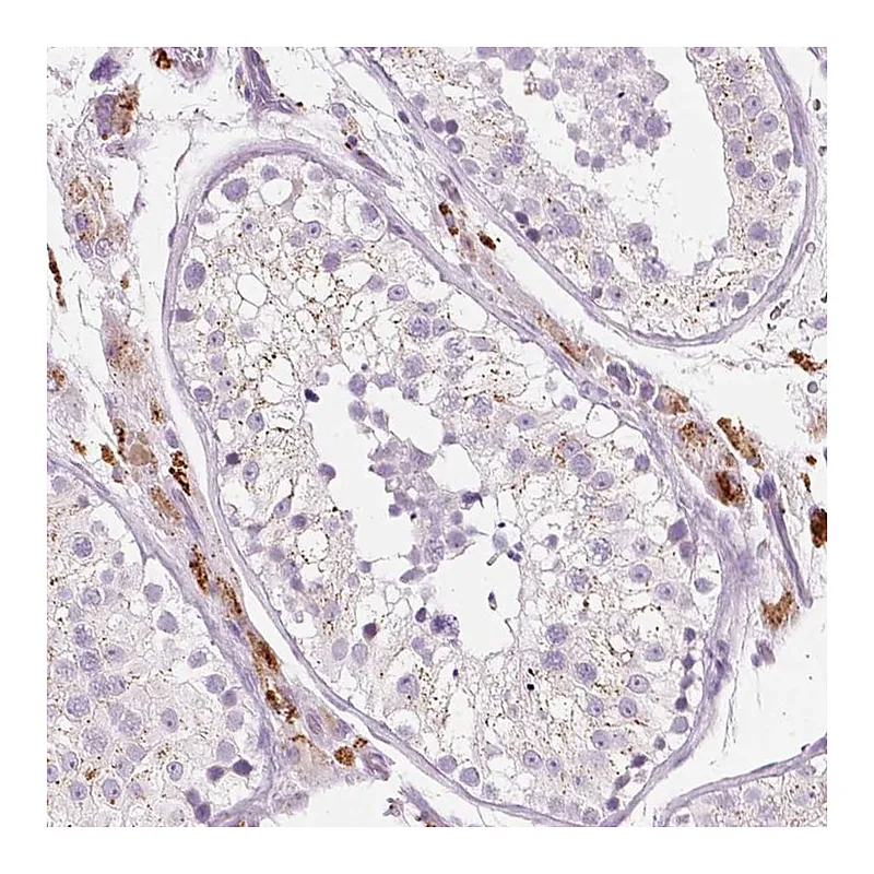 Atlas Antibodies Anti-ZNF639 Antibody