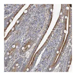 Atlas Antibodies Anti-ZNF641 Antibody