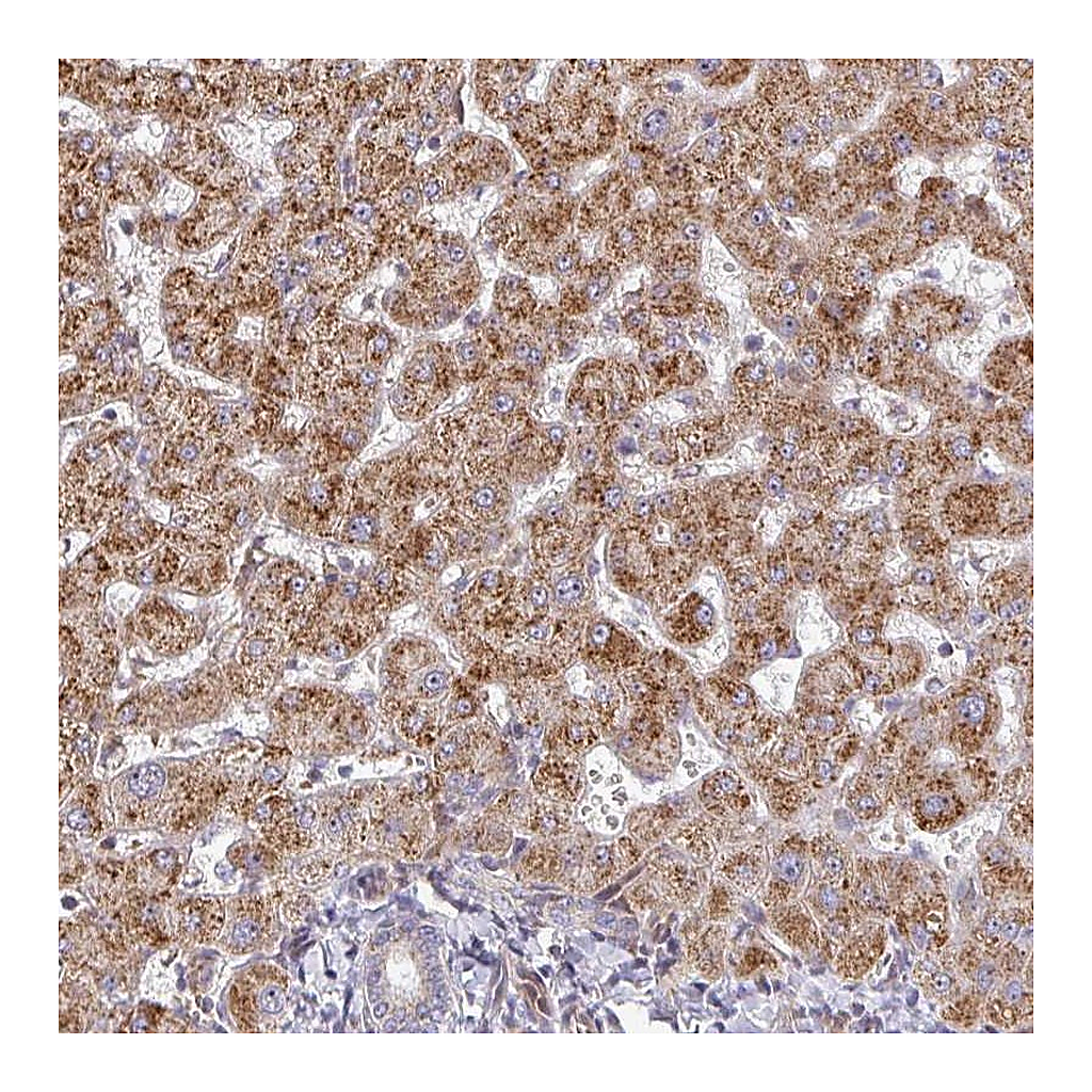 Atlas Antibodies Anti-ZNF644 Antibody