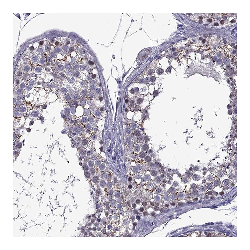 Atlas Antibodies Anti-ZNF646 Antibody
