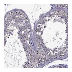 Atlas Antibodies Anti-ZNF646 Antibody