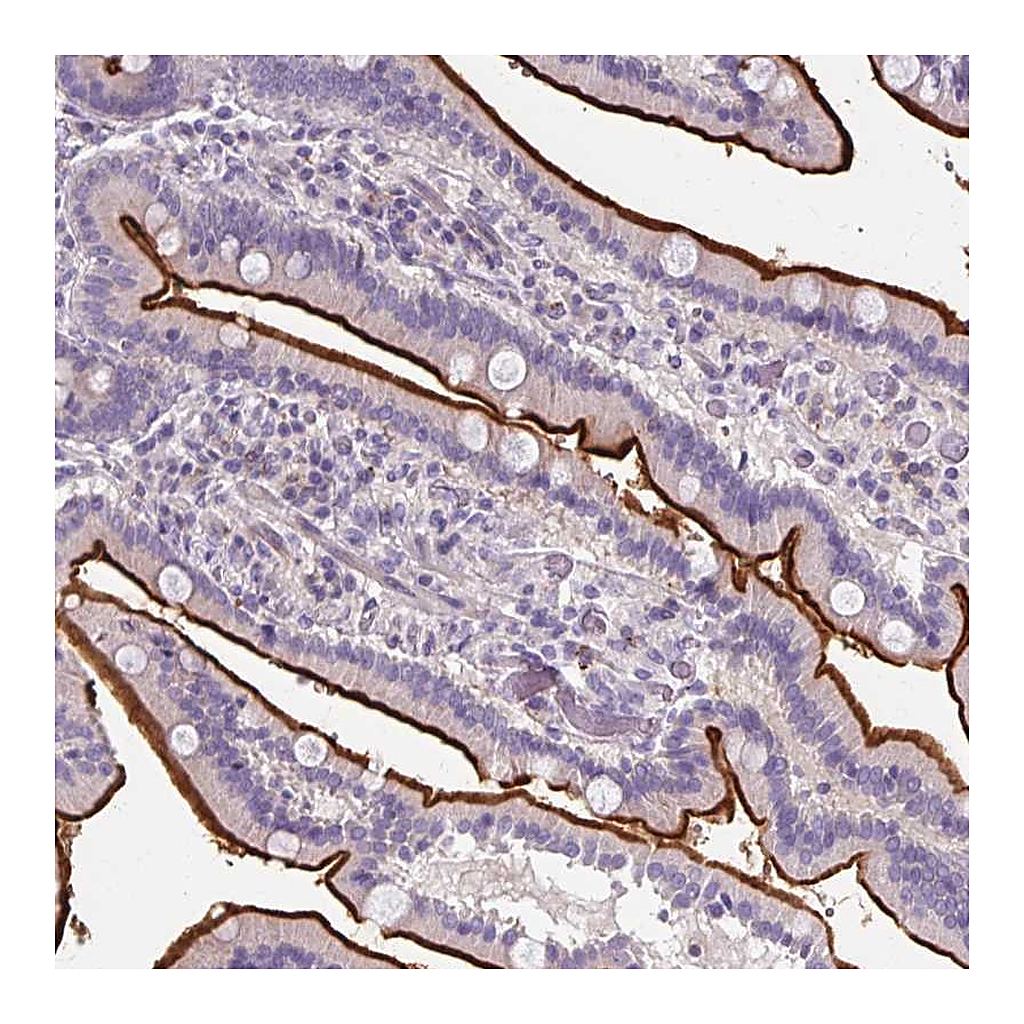 Atlas Antibodies Anti-ZNF648 Antibody