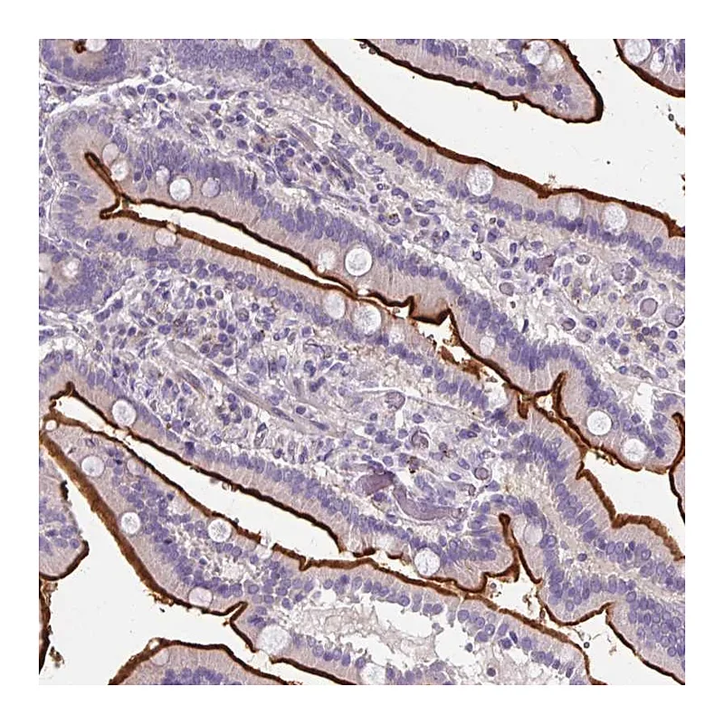 Atlas Antibodies Anti-ZNF648 Antibody