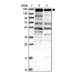 Atlas Antibodies Anti-ZNF646 Antibody