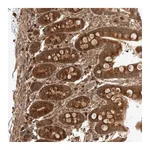 Atlas Antibodies Anti-ZNF649 Antibody