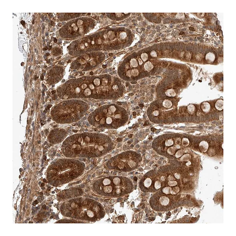 Atlas Antibodies Anti-ZNF649 Antibody
