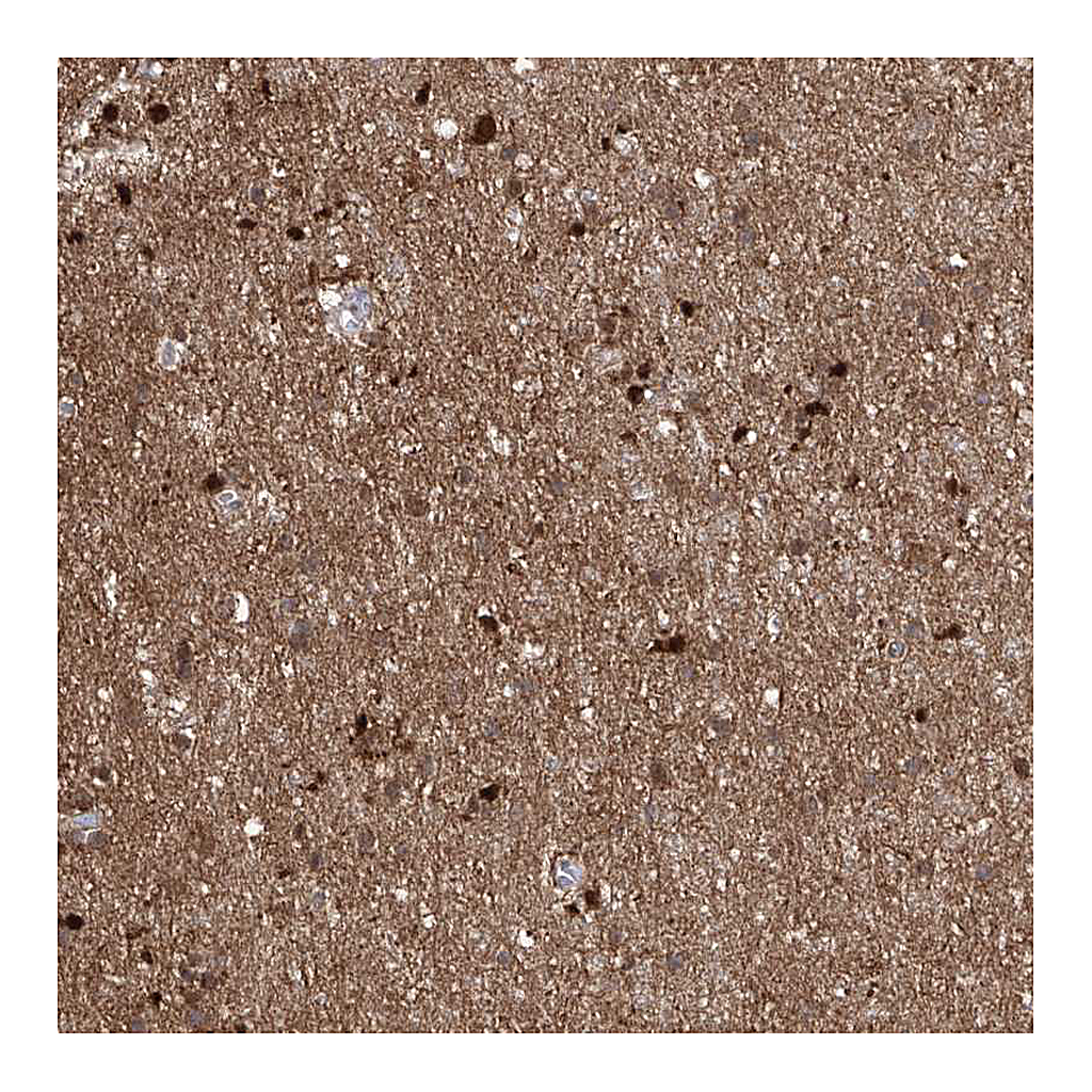 Atlas Antibodies Anti-ZNF653 Antibody