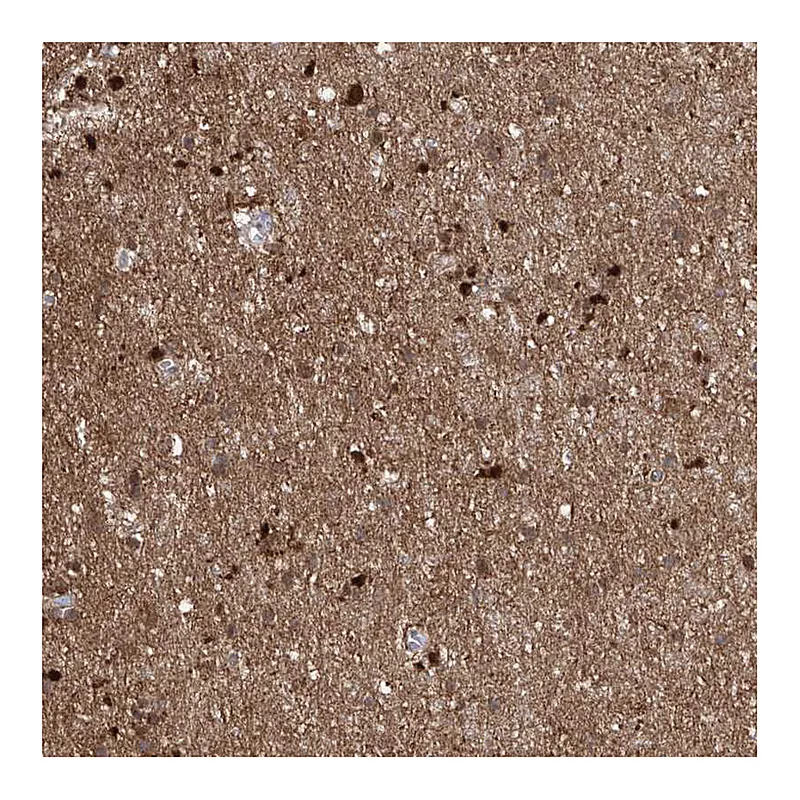 Atlas Antibodies Anti-ZNF653 Antibody