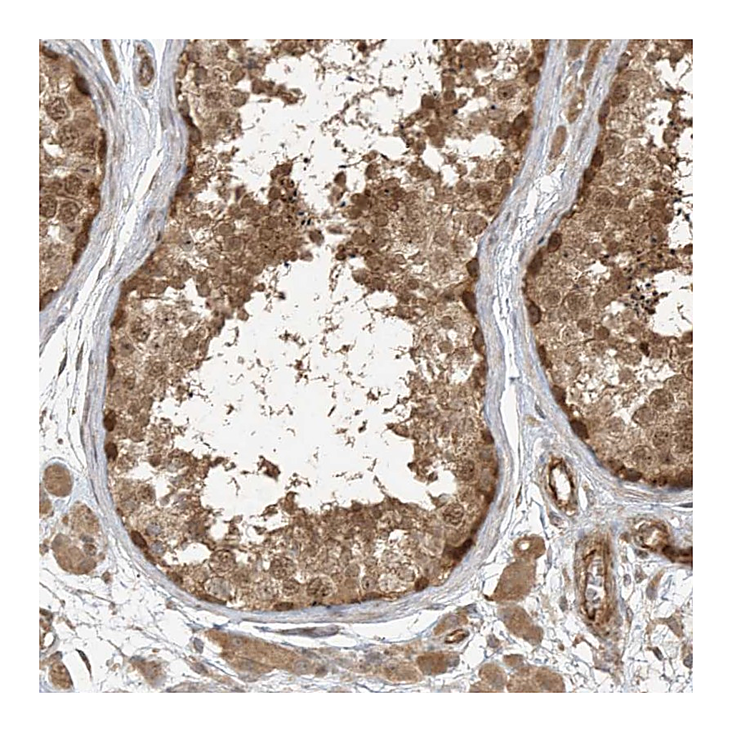 Atlas Antibodies Anti-ZNF653 Antibody