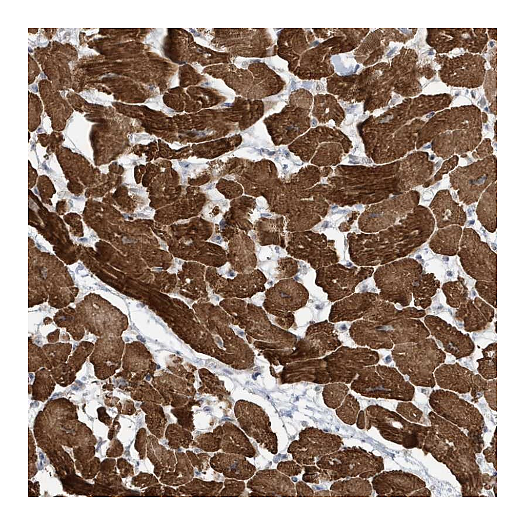 Atlas Antibodies Anti-ZNF654 Antibody