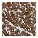 Atlas Antibodies Anti-ZNF654 Antibody
