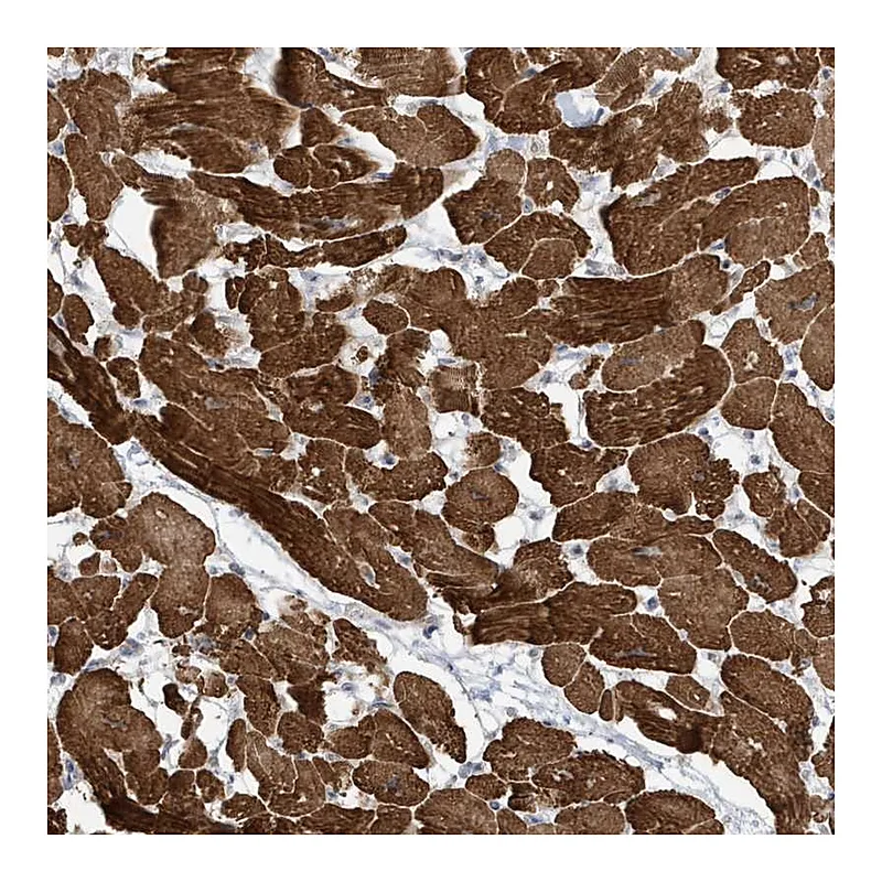 Atlas Antibodies Anti-ZNF654 Antibody