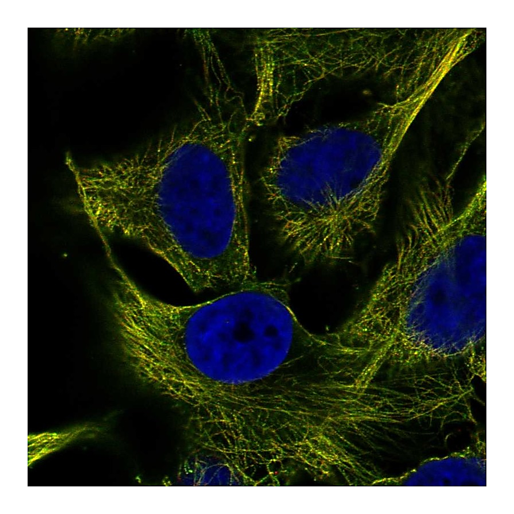 Atlas Antibodies Anti-ZNF654 Antibody