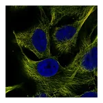 Atlas Antibodies Anti-ZNF654 Antibody