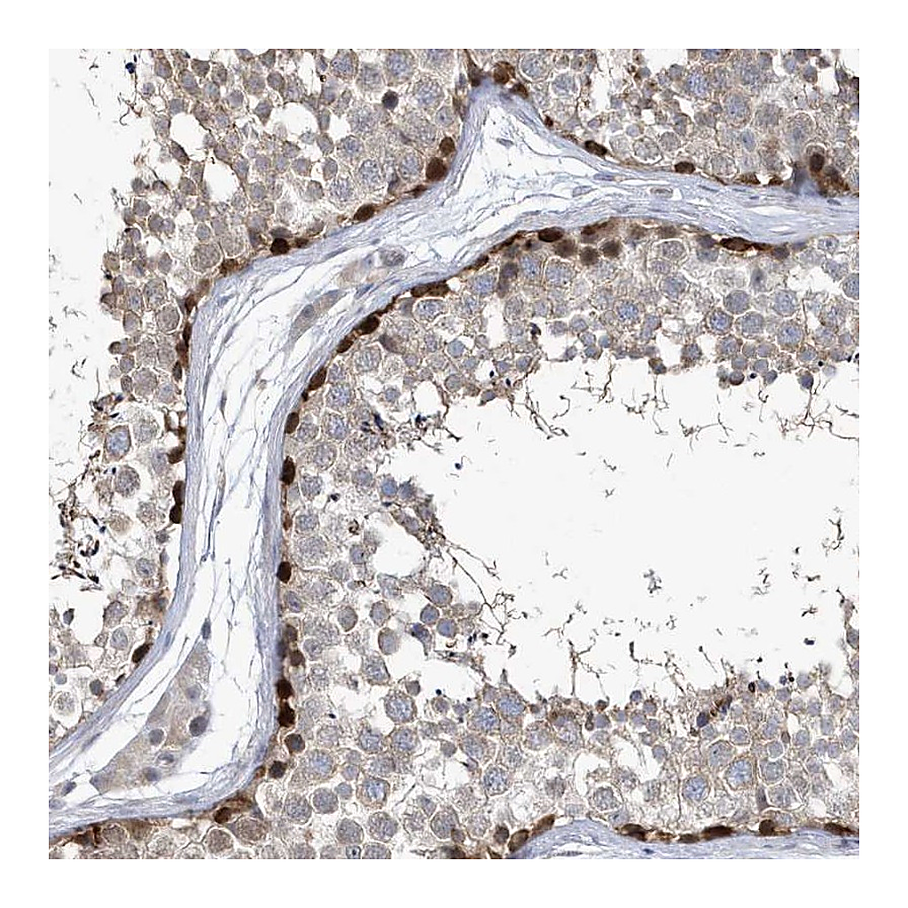 Atlas Antibodies Anti-ZNF654 Antibody