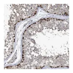 Atlas Antibodies Anti-ZNF654 Antibody