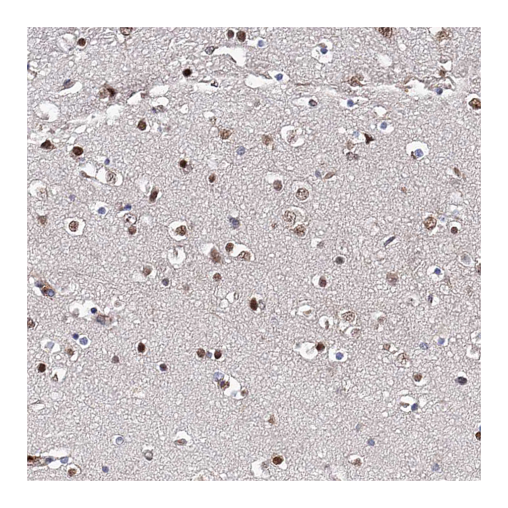Atlas Antibodies Anti-ZNF655 Antibody