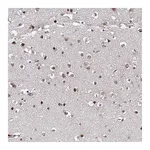 Atlas Antibodies Anti-ZNF655 Antibody