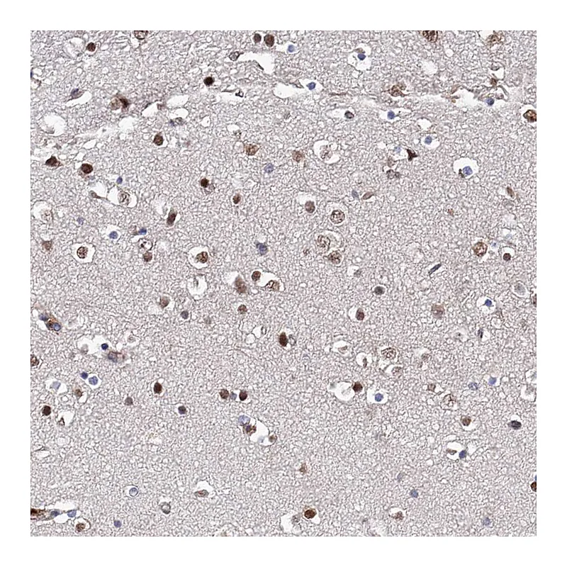 Atlas Antibodies Anti-ZNF655 Antibody