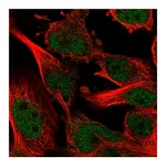 Atlas Antibodies Anti-ZNF655 Antibody