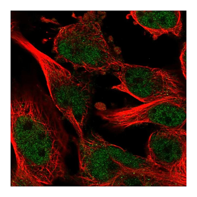 Atlas Antibodies Anti-ZNF655 Antibody