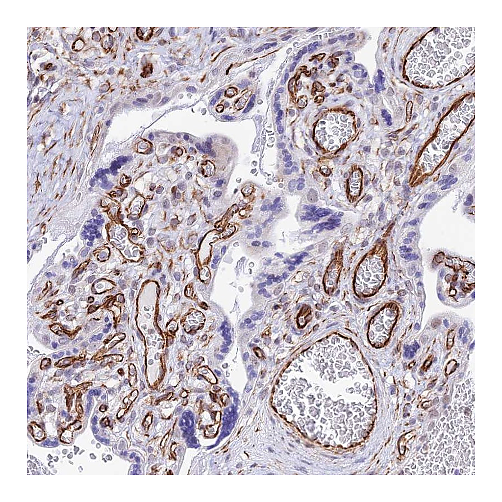 Atlas Antibodies Anti-ZNF652 Antibody
