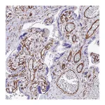 Atlas Antibodies Anti-ZNF652 Antibody